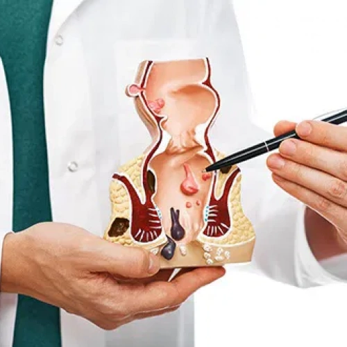 Basur Yastığı Olan Hemoroid Yastığının Faydaları