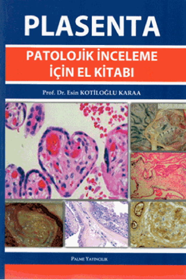 Plasenta Patolojik İnceleme İçin El Kitabı