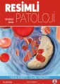 Resimli Patoloji