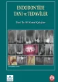 Endodontide Tanı ve Tedaviler