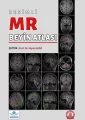 Resimli MR Beyin Atlası