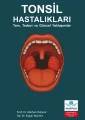 Tonsil Hastalıkları - Tanı, Tedavi ve Güncel Yaklaşımlar
