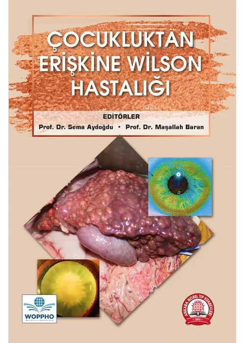 Çocukluktan Erişkine Wilson Hastalığı
