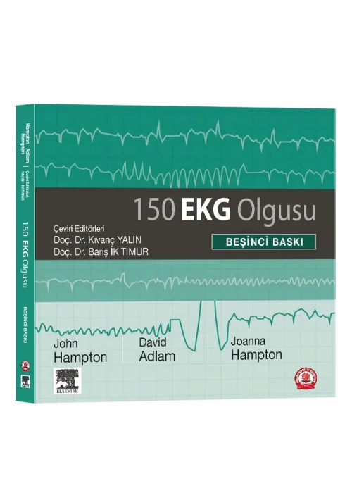 150 EKG Olgusu