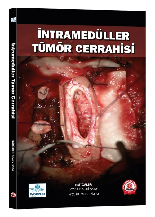 İntramedüller Tümör Cerrahisi