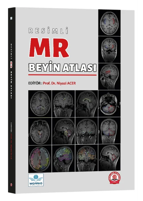 Resimli MR Beyin Atlası