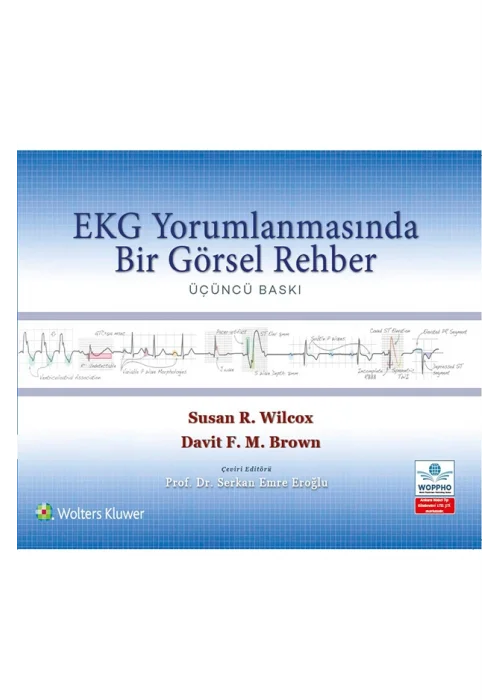 EKG Yorumlamasında Bir Görsel Rehber