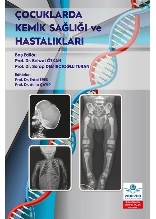 Çocuklarda Kemik Sağlığı ve Hastalıkları