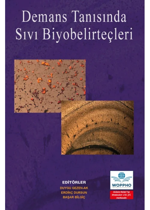 Demans Tanısında Sıvı Biyobelirteçler