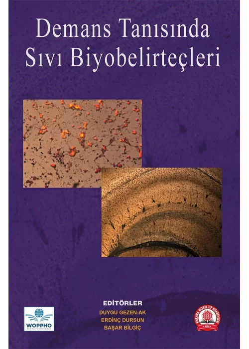 Demans Tanısında Sıvı Biyobelirteçler