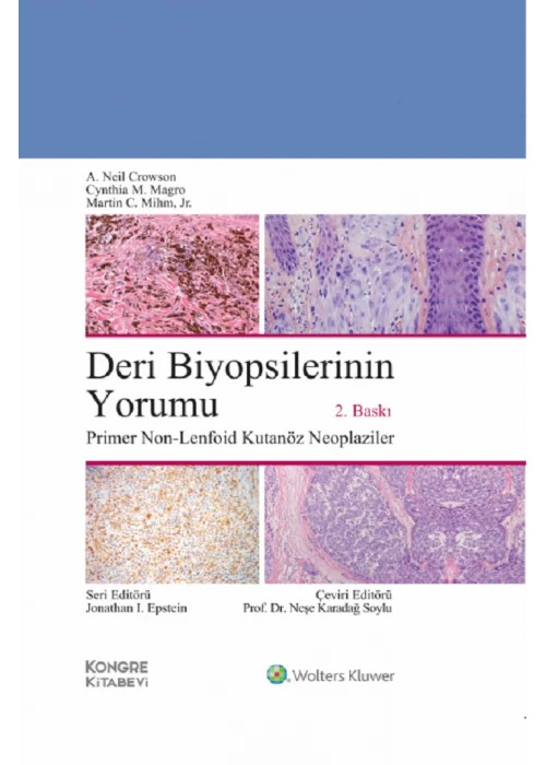 Deri Biyopsilerinin Yorumu: Primer Non-Lenfoid Kutanöz Neoplaziler 2.BASKI