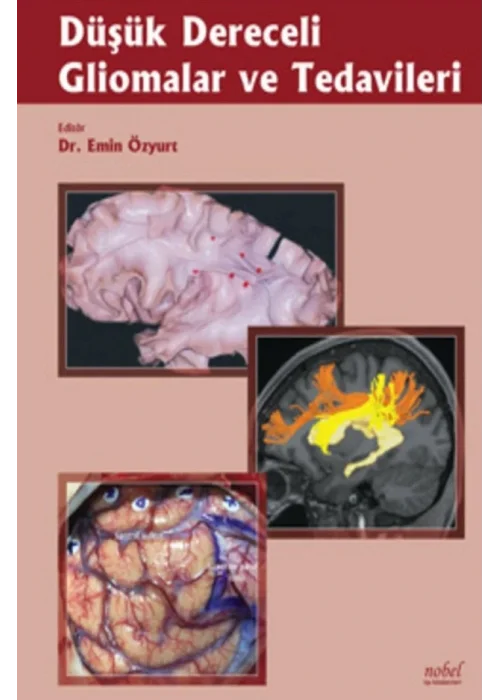 Düşük Dereceli Gliomalar ve Tedavileri