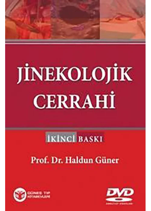Jinekolojik Cerrahi - Haldun Güner