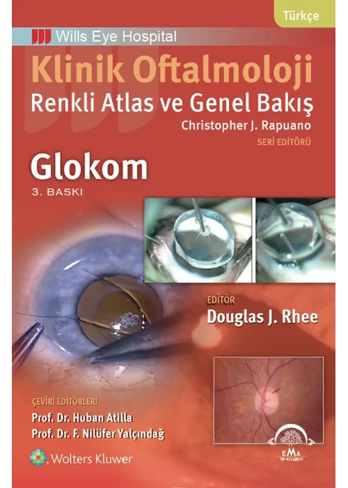 Klinik Oftalmoloji Renkli Atlas ve Genel Bakış - GLOKOM