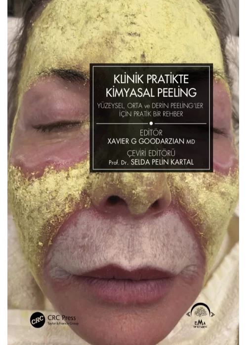 Klinik Pratikte Kimyasal Peeling