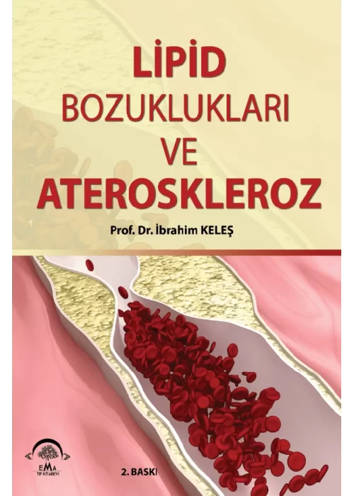 Lipid Bozuklukları ve Ateroskleroz