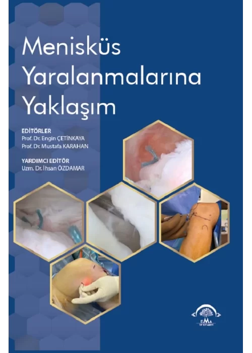 Menisküs Yaralanmalarına Yaklaşım