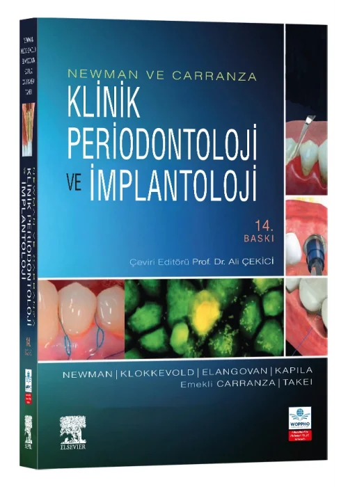Newman ve Carranza Klinik Periodontoloji ve İmplantoloji 14. Baskı ÖN SİPARİŞ