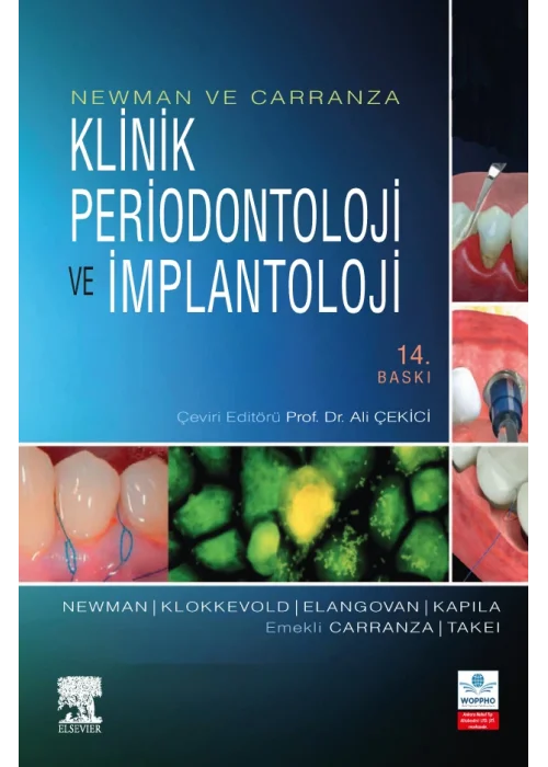Newman ve Carranza Klinik Periodontoloji ve İmplantoloji 14. Baskı ÖN SİPARİŞ