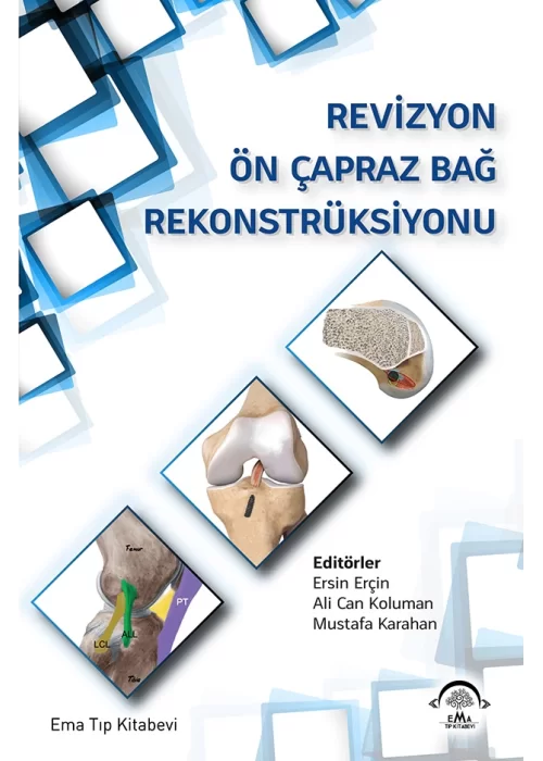 Revizyon Ön Çapraz Bağ Rekonstrüksiyonu
