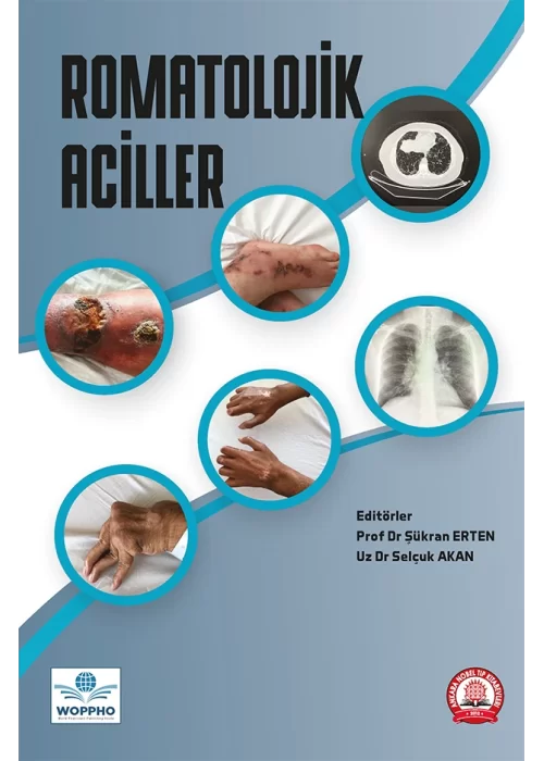 Romatolojik Aciller