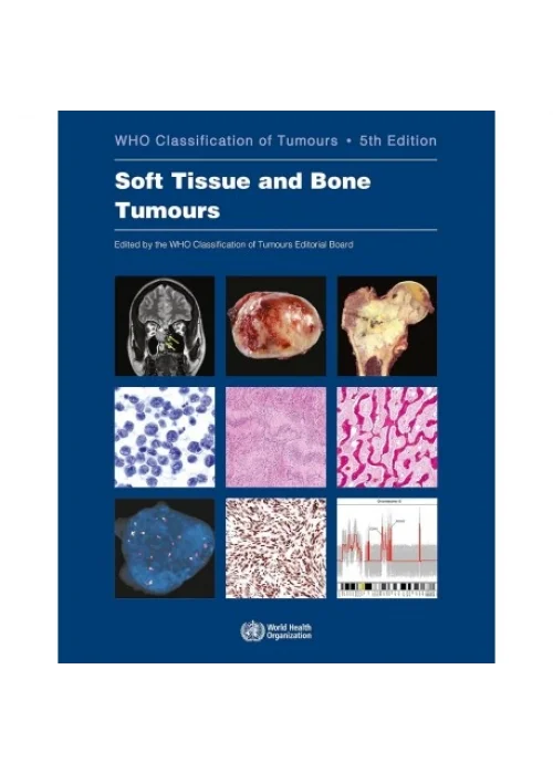 Soft Tissue and Bone Tumours WHO Classification of Tumours, 5th