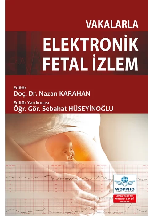 Vakalarla Elektronik Fetal İzlem
