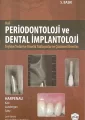 Periodontoloji ve Dental İmplantoloji - Hall