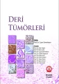 Deri Tümörleri