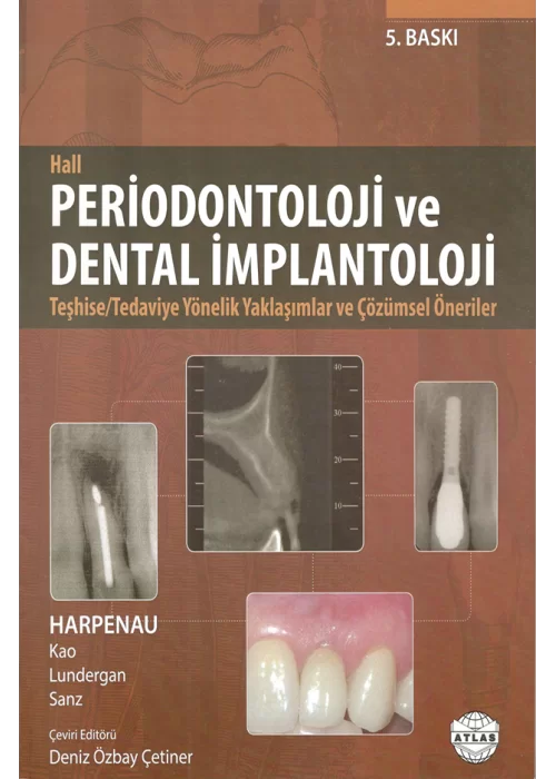 Periodontoloji ve Dental İmplantoloji - Hall
