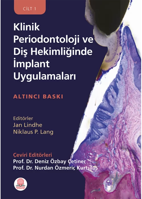 Klinik Periodontoloji ve Diş Hekimliğinde İmplant Uygulamaları