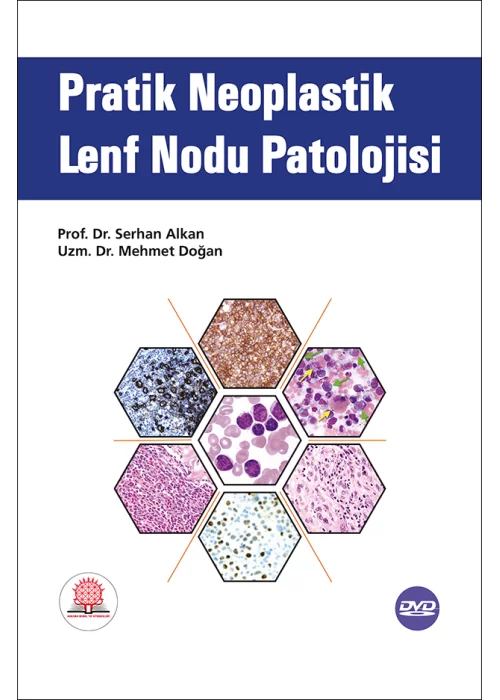 Pratik Neoplastik Lenf Nodu Patolojisi