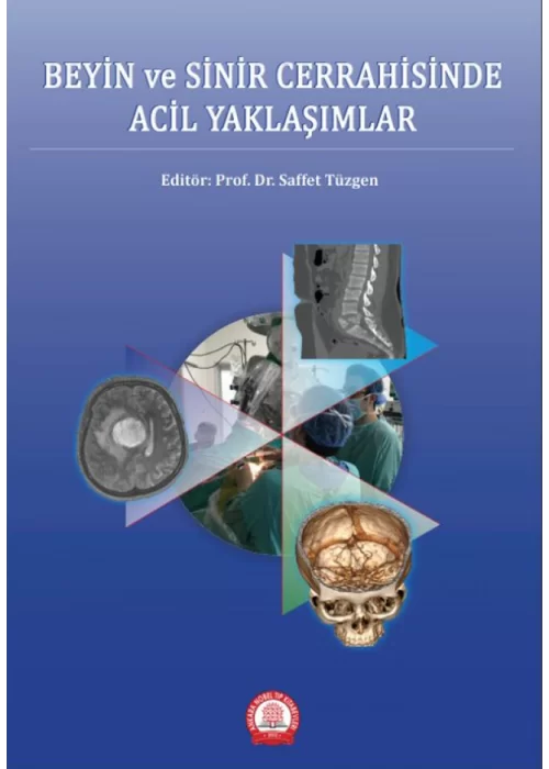 Beyin ve Sinir Cerrahisinde Acil Yaklaşımlar