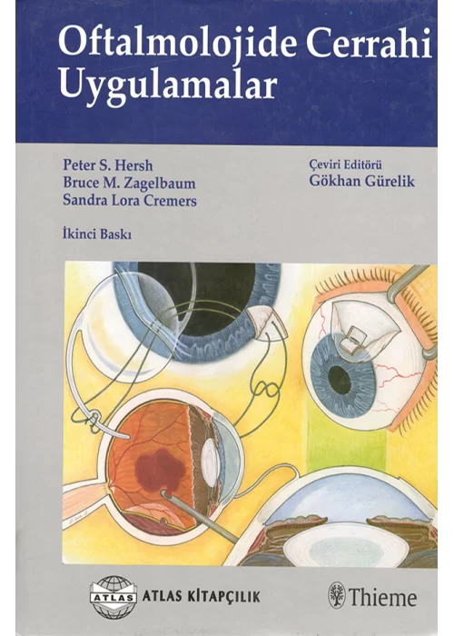 Oftalmolojide Cerrahi Uygulamalar