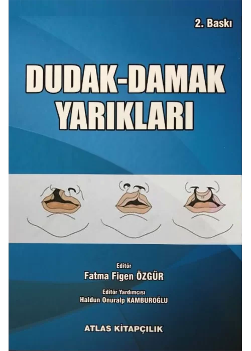 Dudak Damak Yarıkları