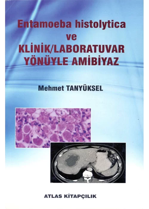 Entamoeba histolytica ve Klinik Laboratuvar Yönüyle Ambiyaz
