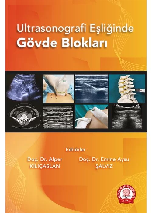 Ultrasonografi Eşliğinde Gövde Blokları