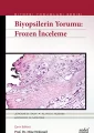 Biyopsilerin Yorumu: Frozen İnceleme