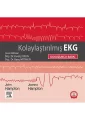 Kolaylaştırılmış EKG