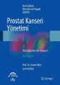 Prostat Kanseri Yönetimi