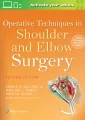 Operative Techniques in Shoulder and Elbow Surgery