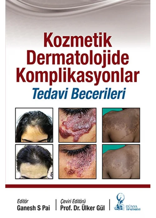 Kozmetik Dermatolojide Komplikasyonlar Tedavi Becerileri