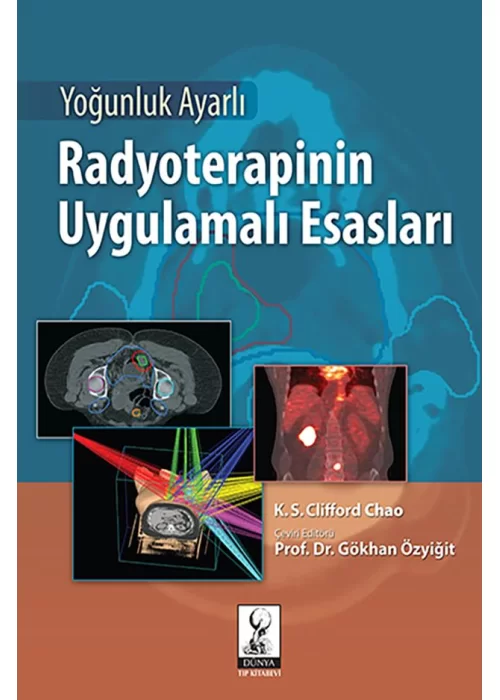 Yoğunluk Ayarlı Radyoterapinin Uygulamalı Esasları (IST)
