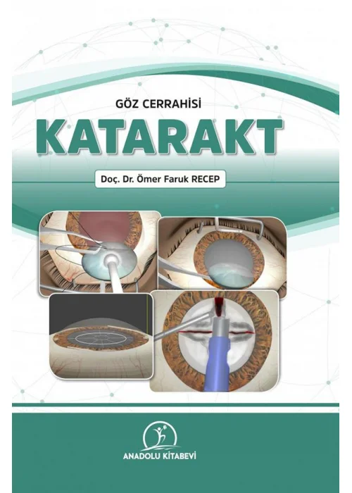 Göz Cerrahisi Katarakt
