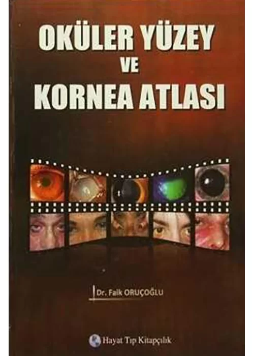 Oküler Yüzey ve Kornea Atlası