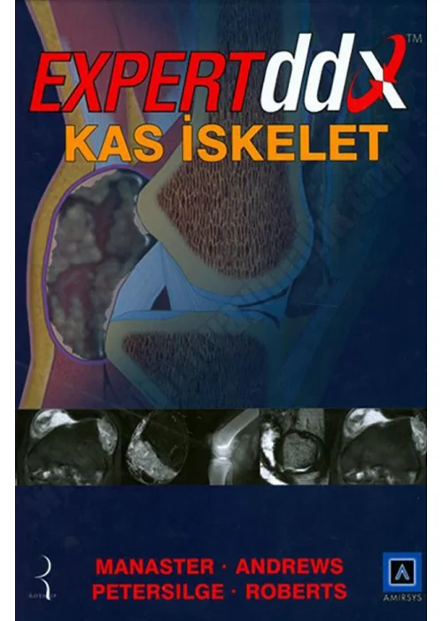 Expert DDX Kas İskelet