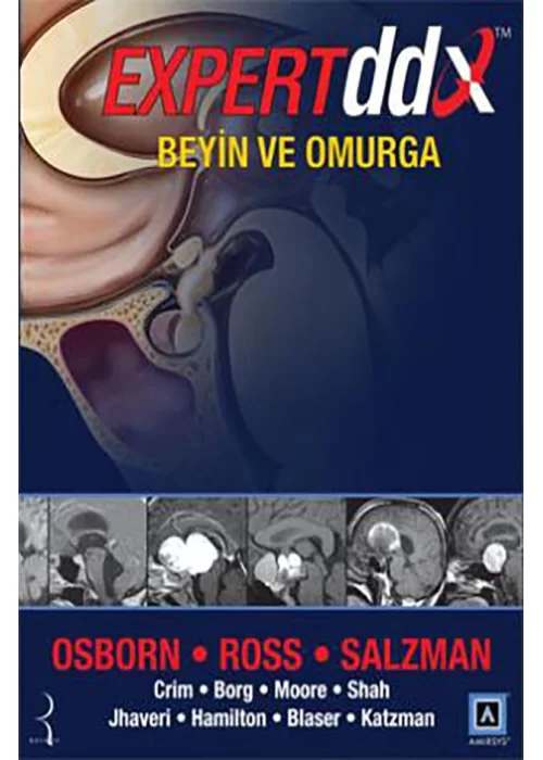 Expert DDX Beyin ve Omurga