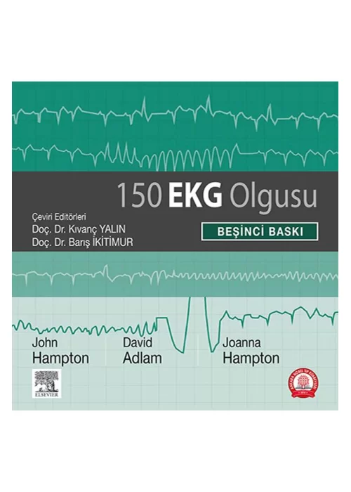 150 EKG Olgusu