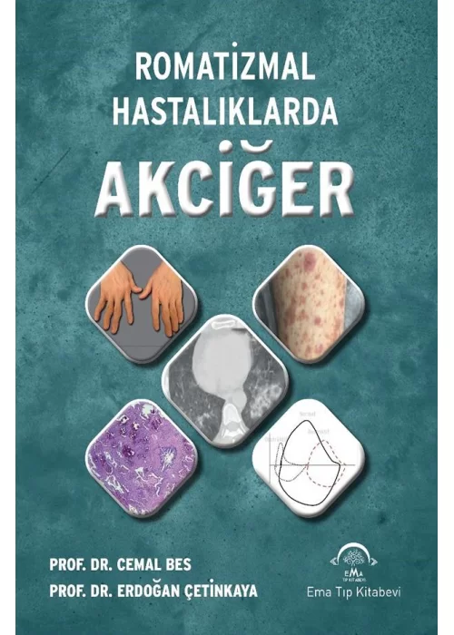 Romatizmal Hastalıklarda Akciğer
