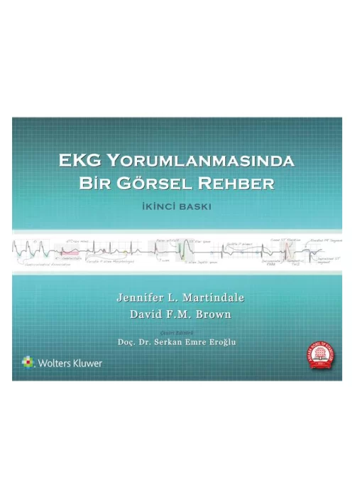 EKG Yorumlanmasında Bir Görsel Rehber